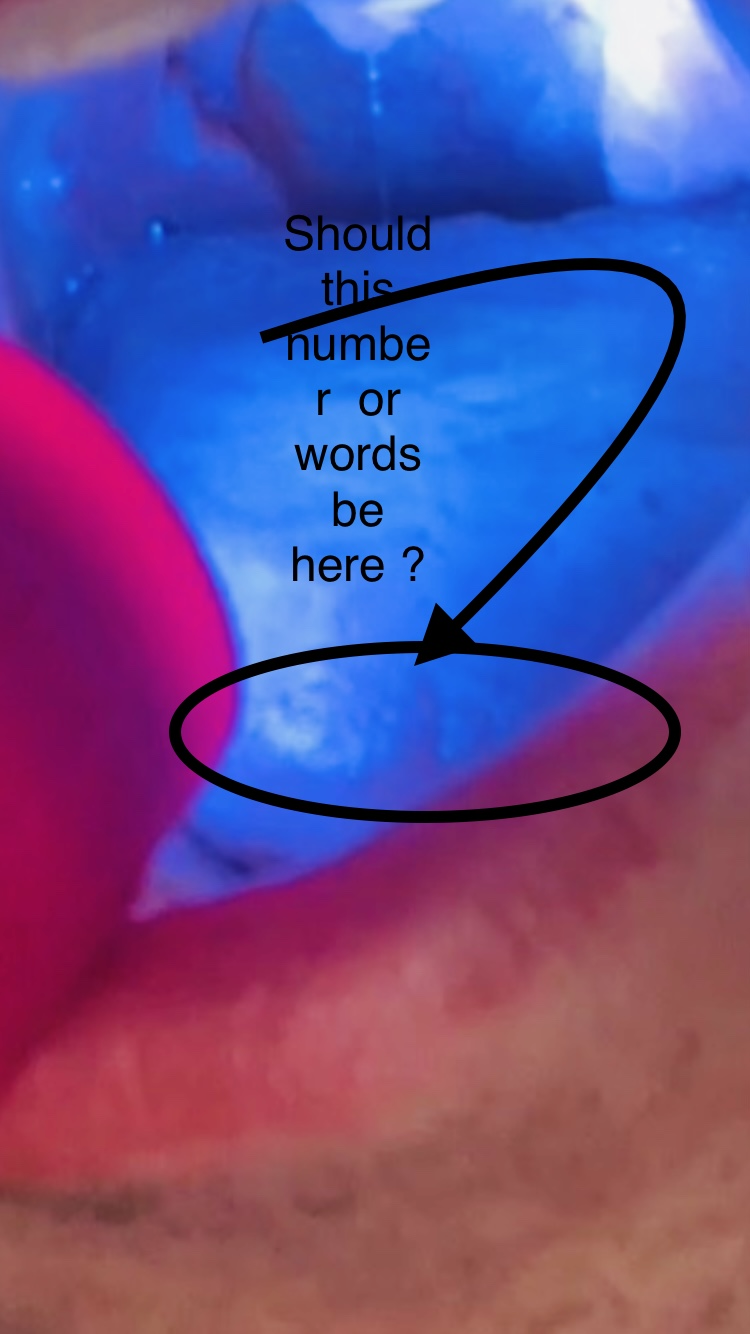 Can you see it ?