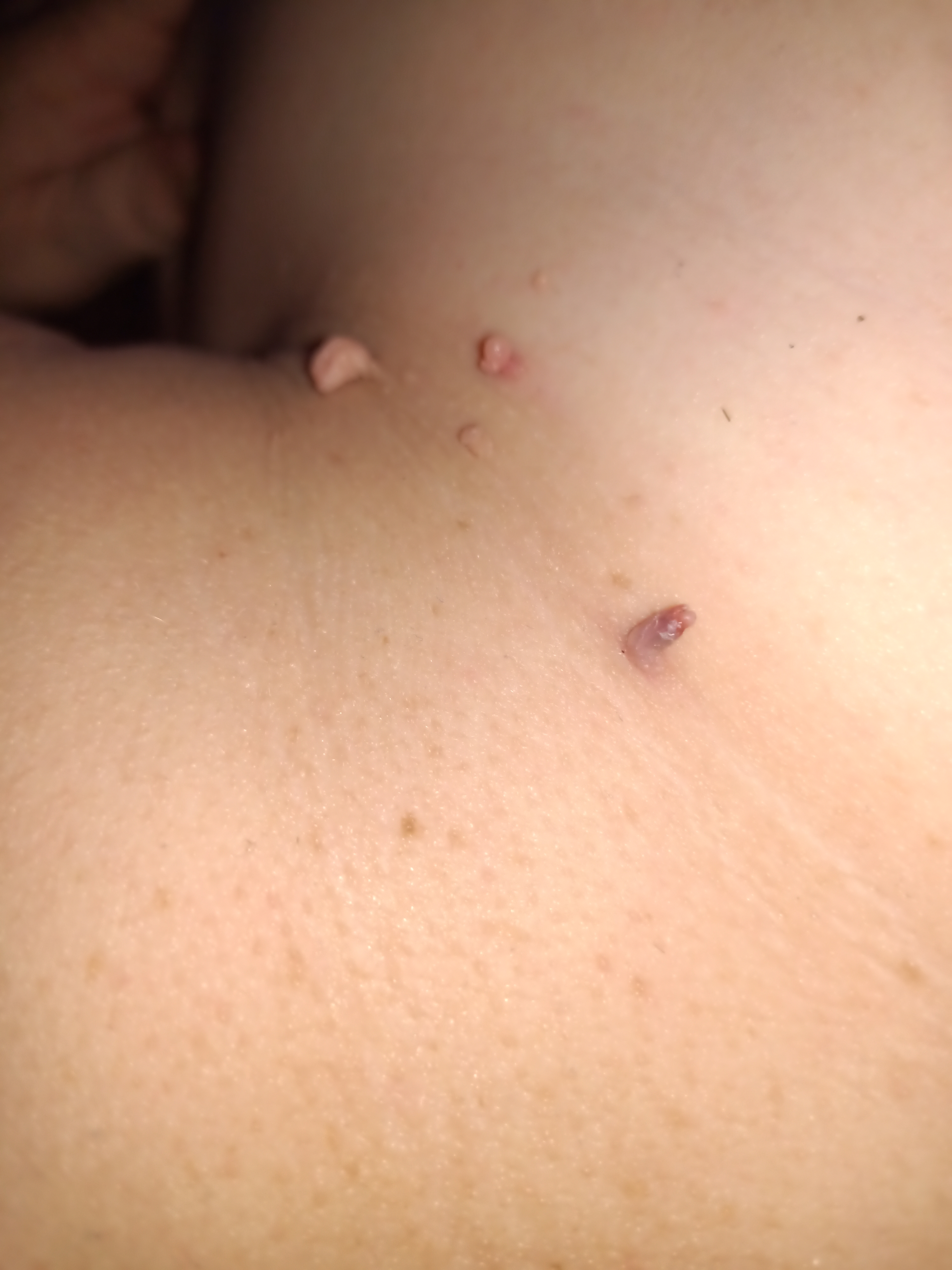 Fibrom and Figur