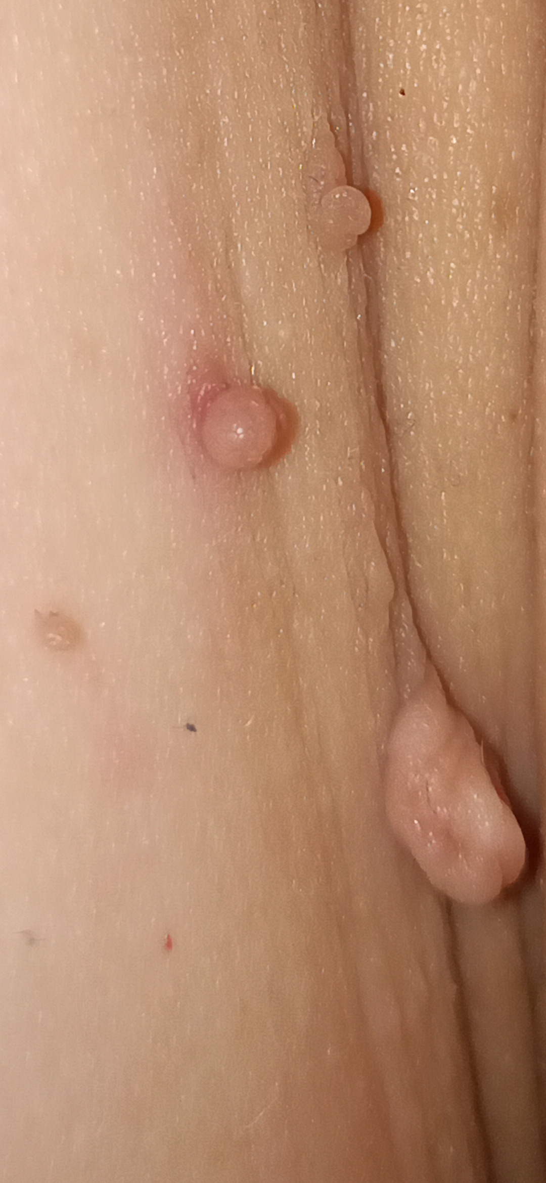 Fibrom and Figur