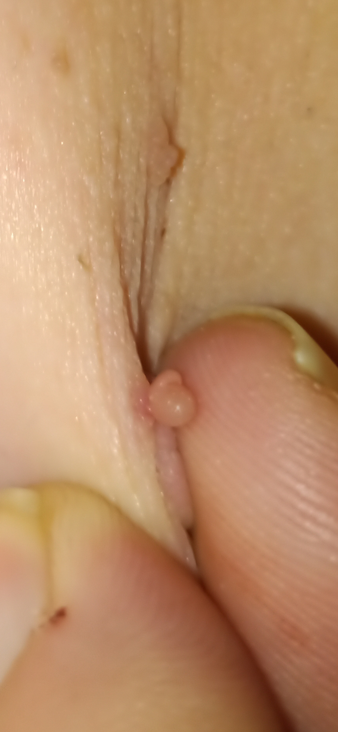 Fibrom and Figur