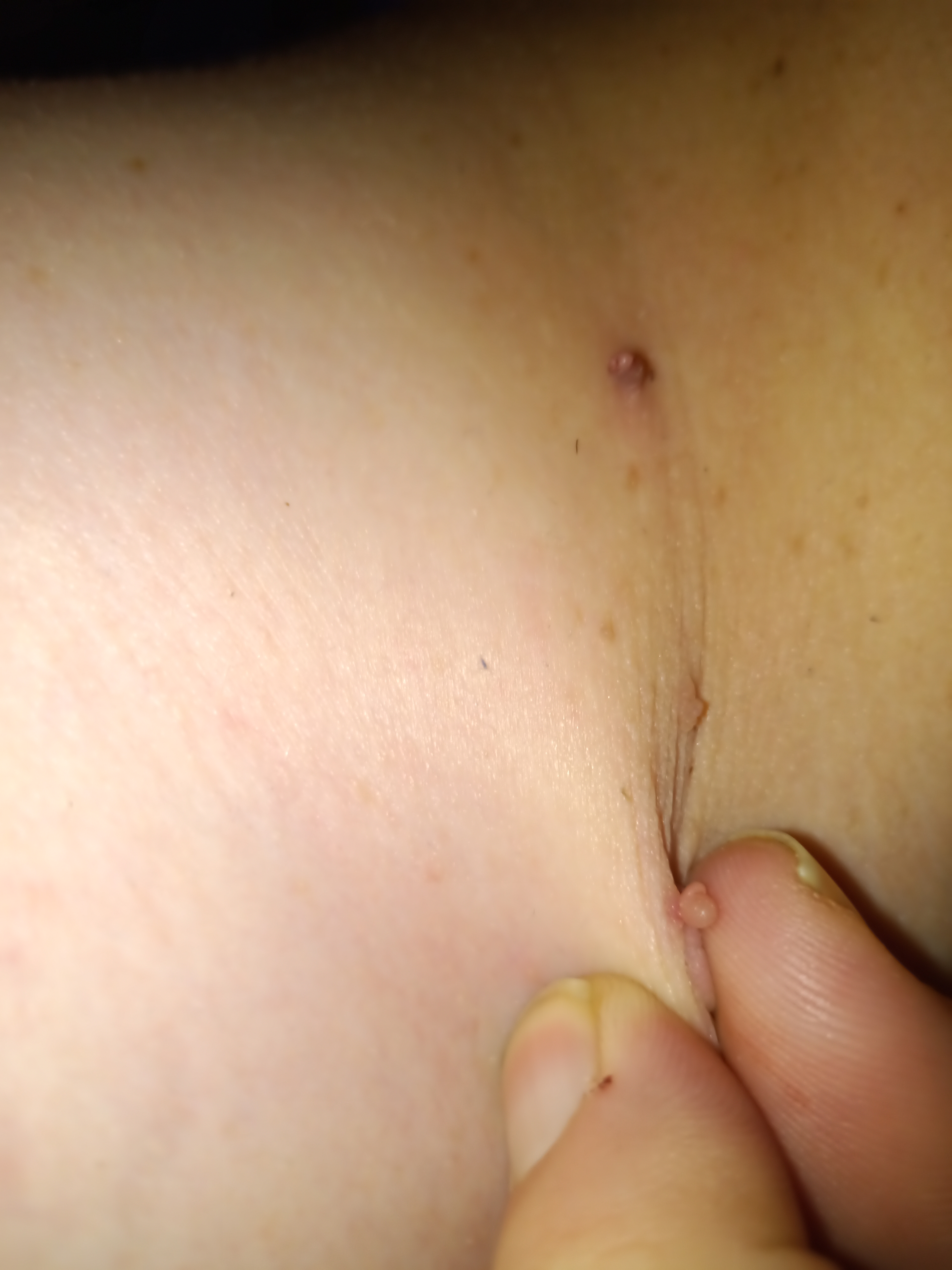 Fibrom and Figur