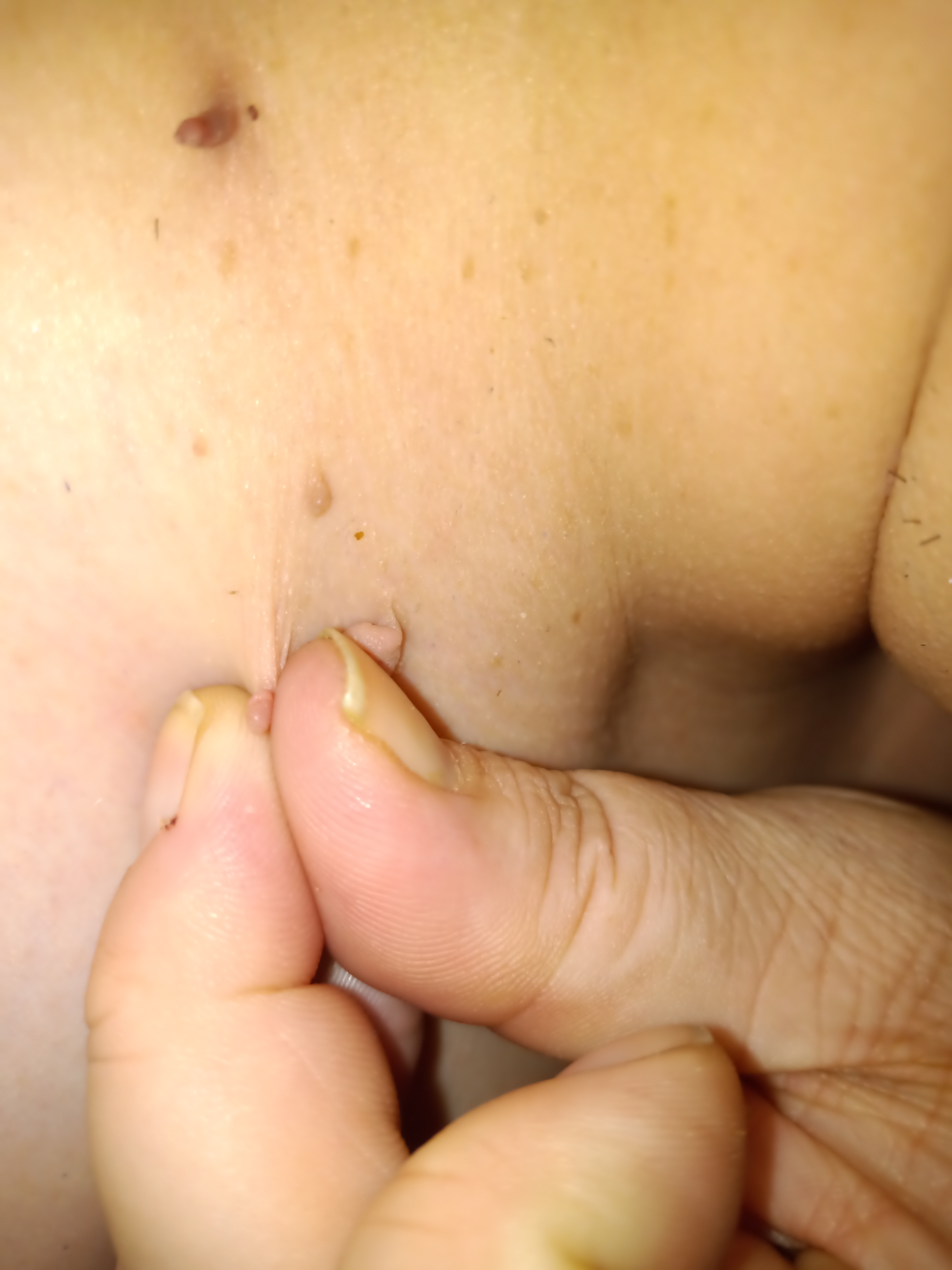 Fibrom and Figur