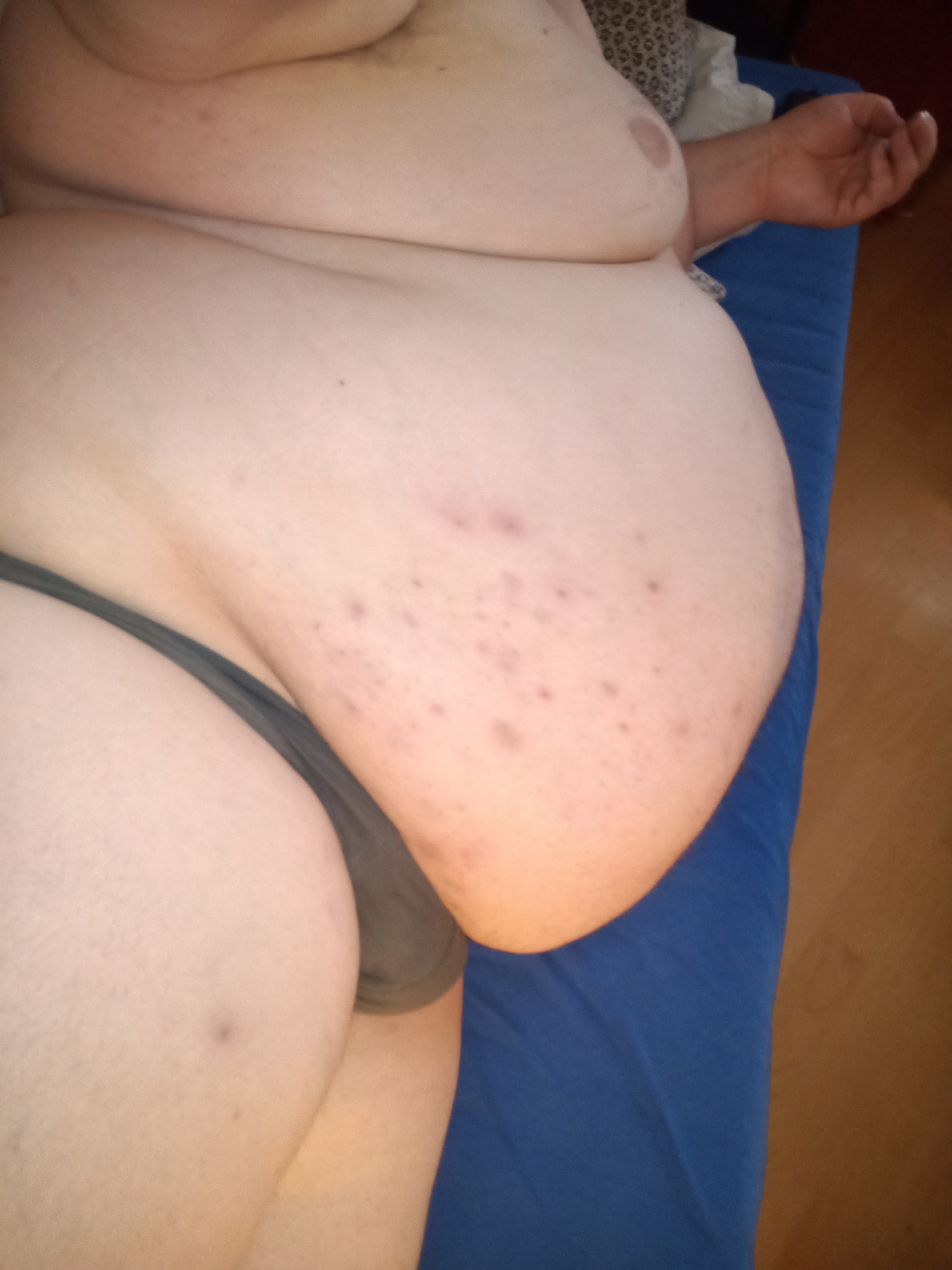 Fibrom and Figur
