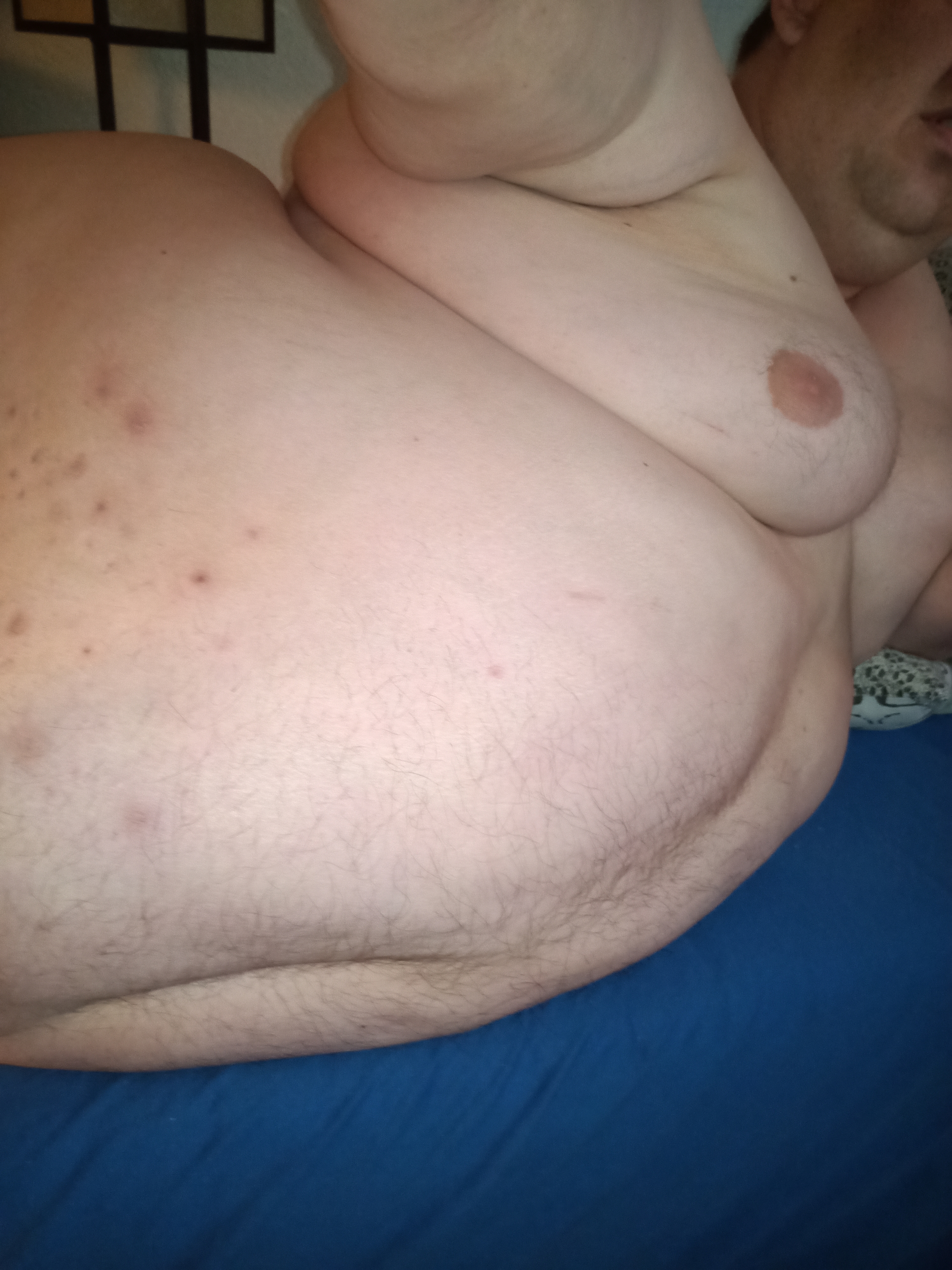 Fibrom and Figur