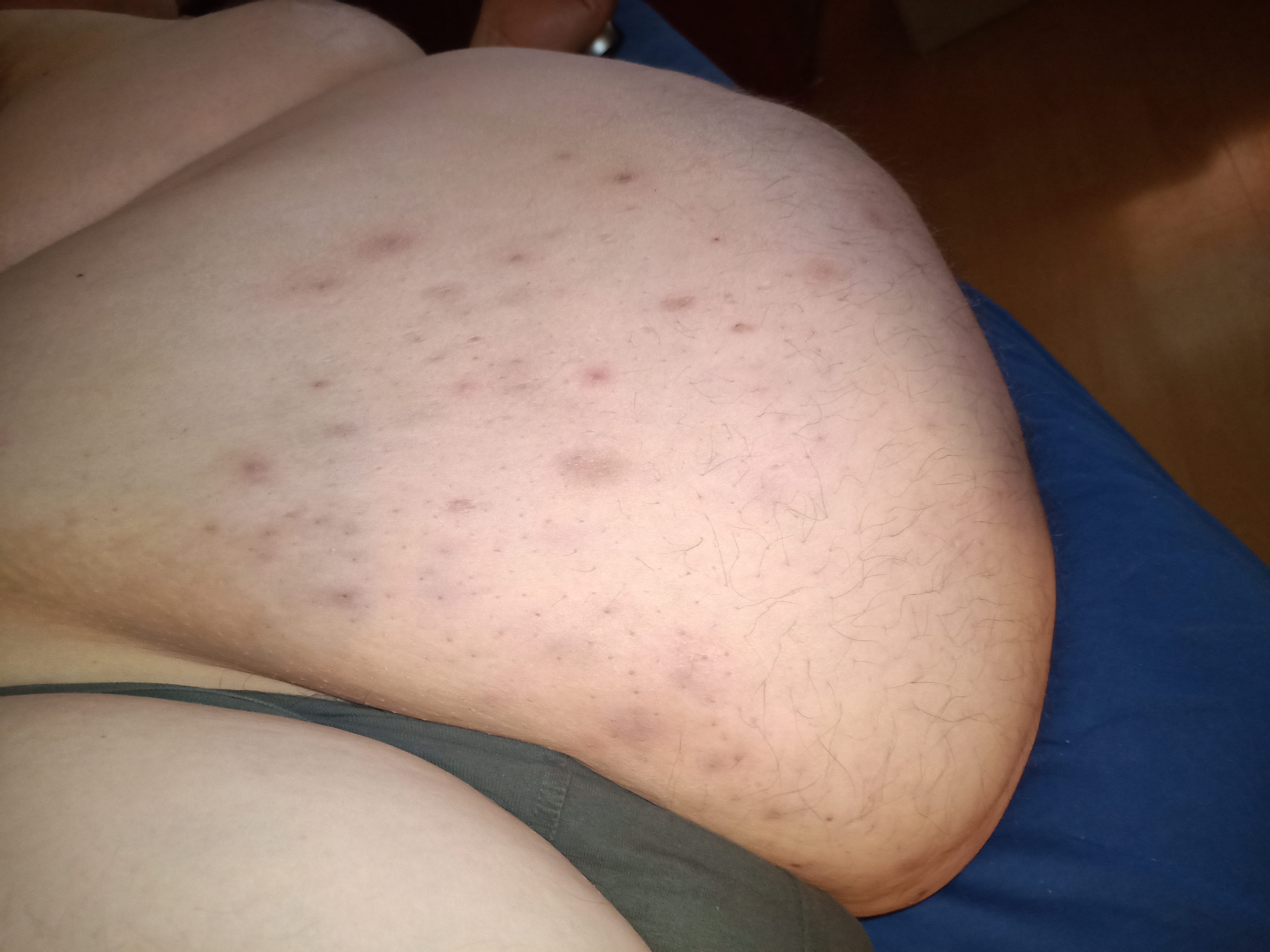 Fibrom and Figur