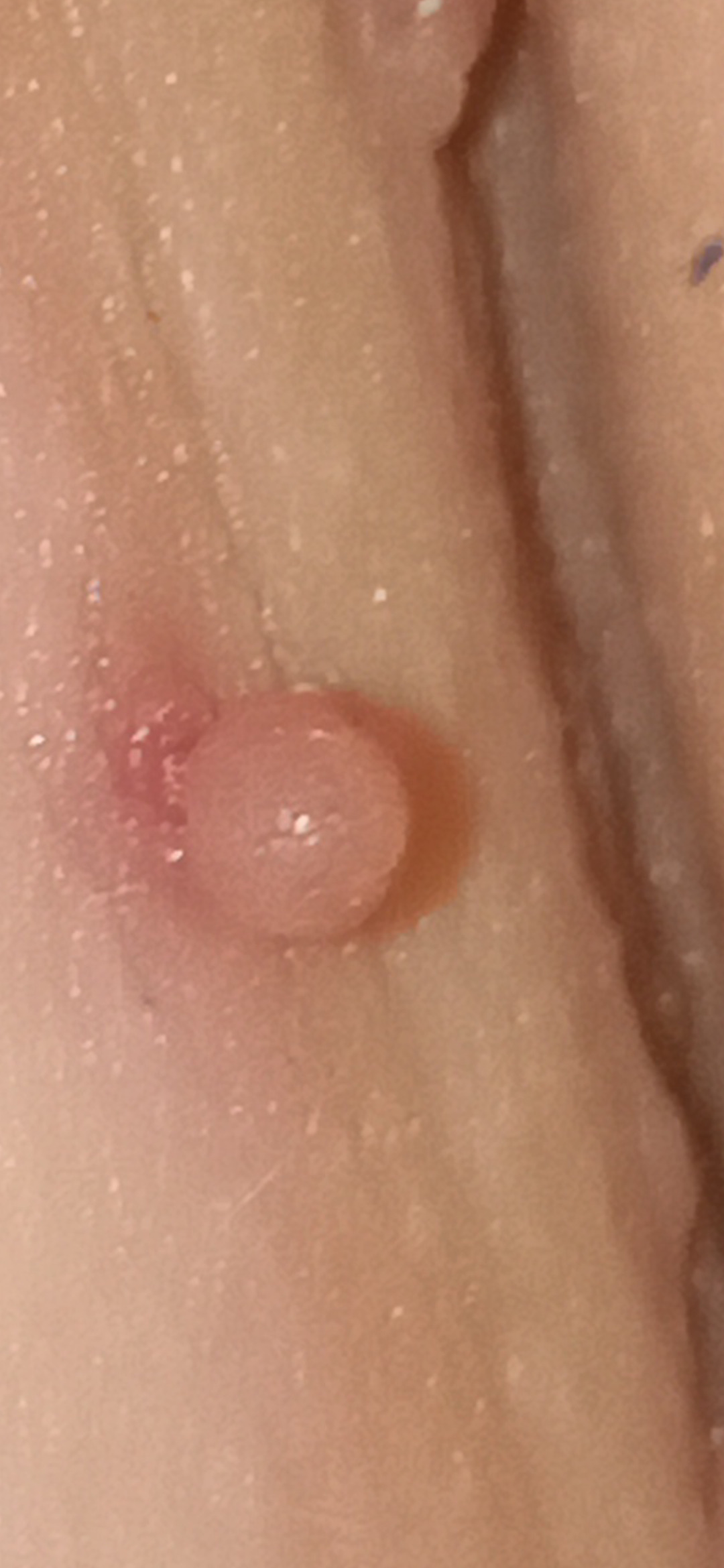 Fibrom and Figur