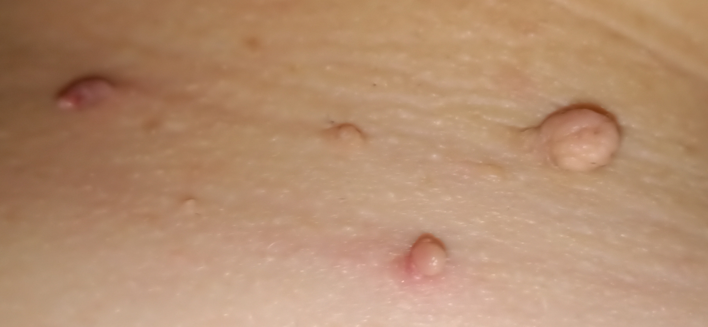 Fibrom and Figur