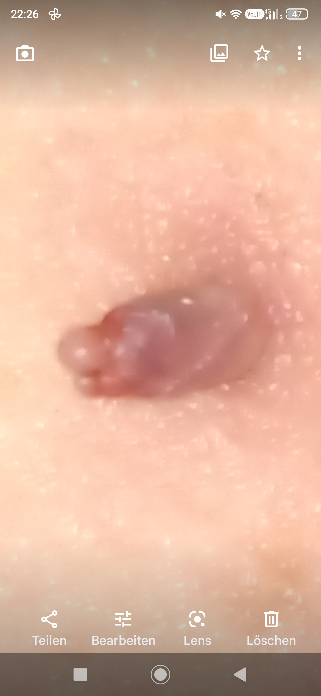 Fibrom and Figur