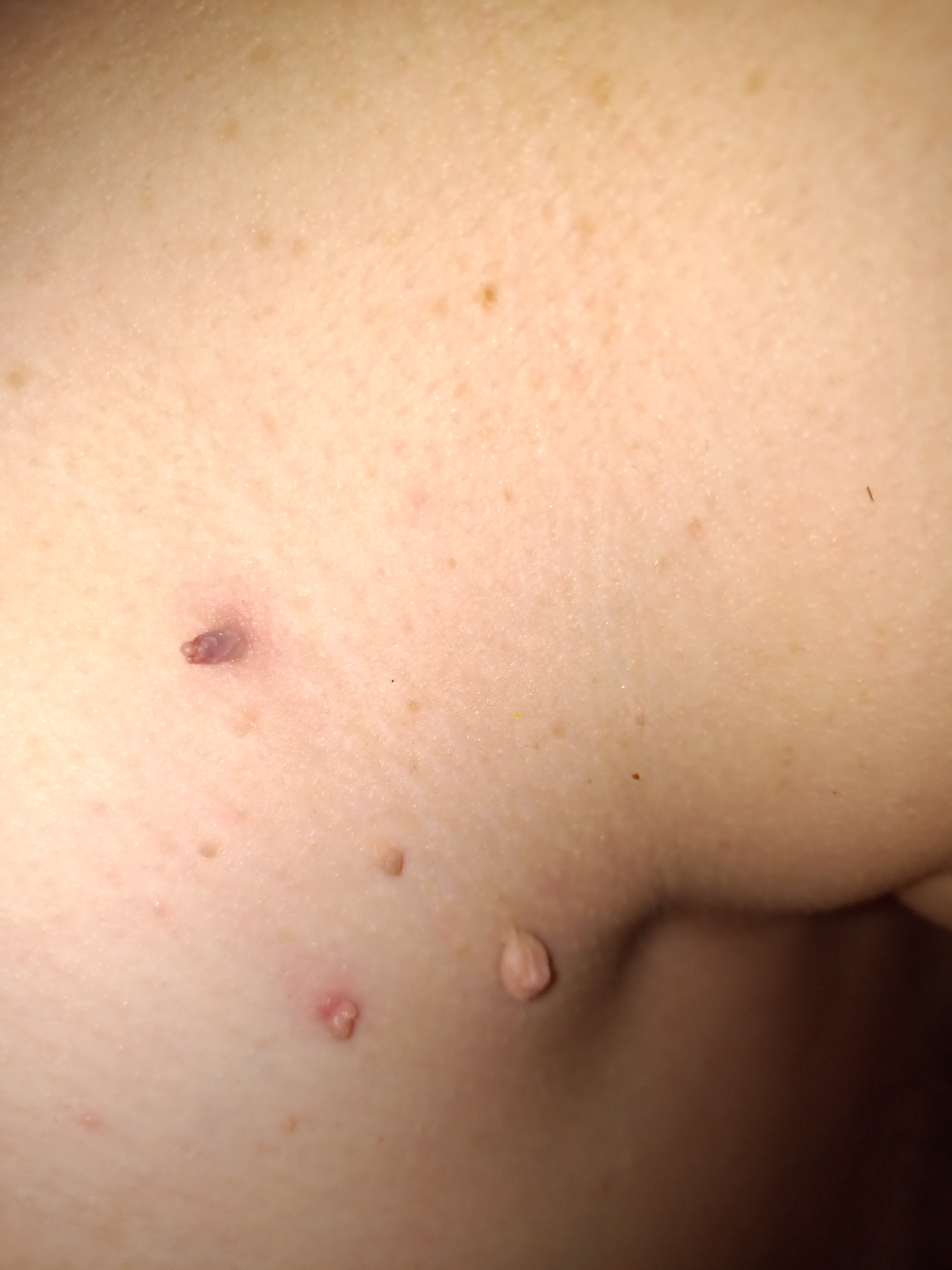 Fibrom and Figur