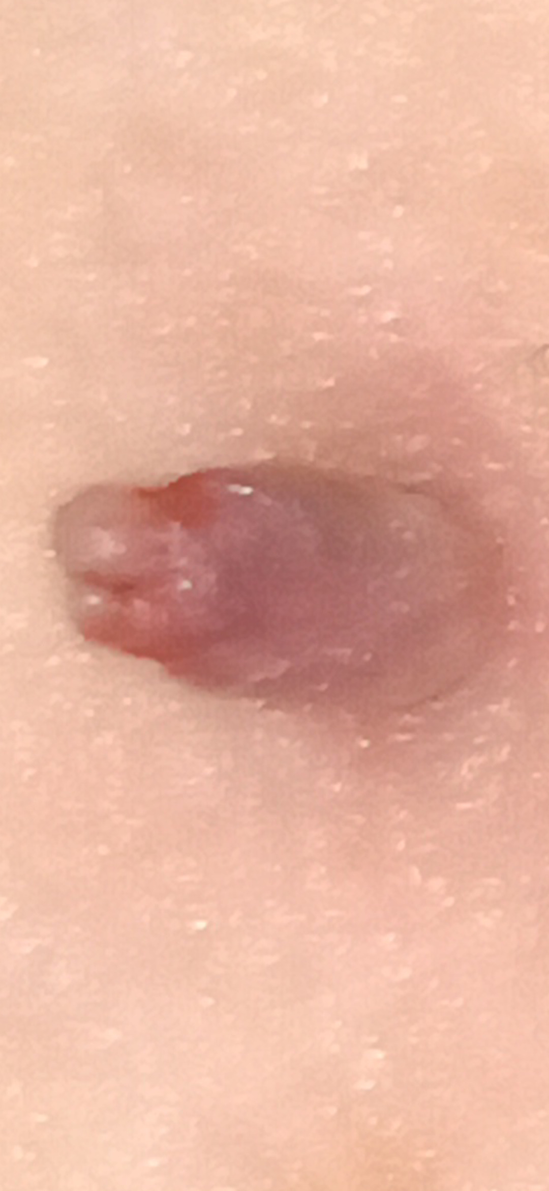 Fibrom and Figur