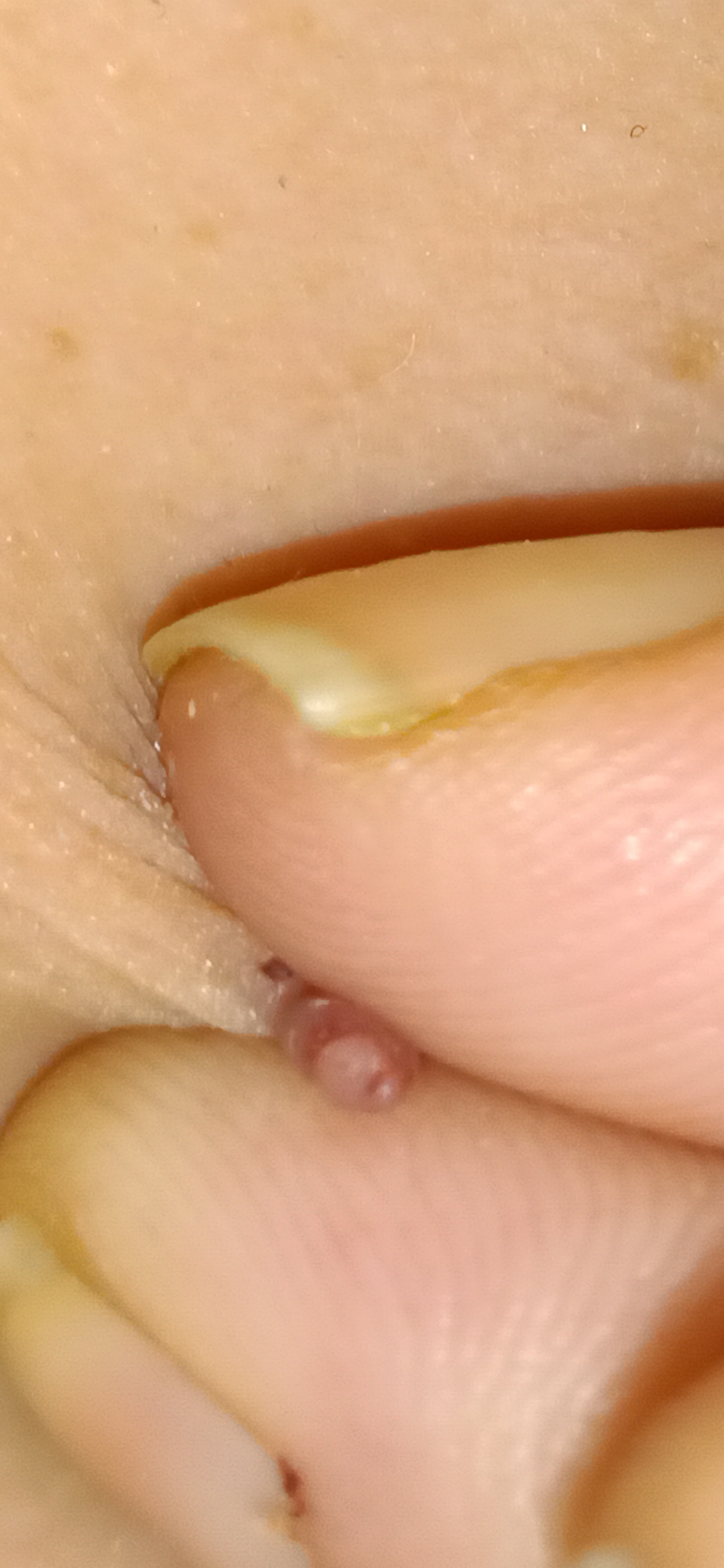 Fibrom and Figur