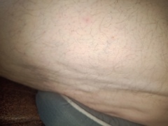 Cellulite