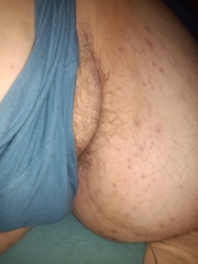 Unterbauch