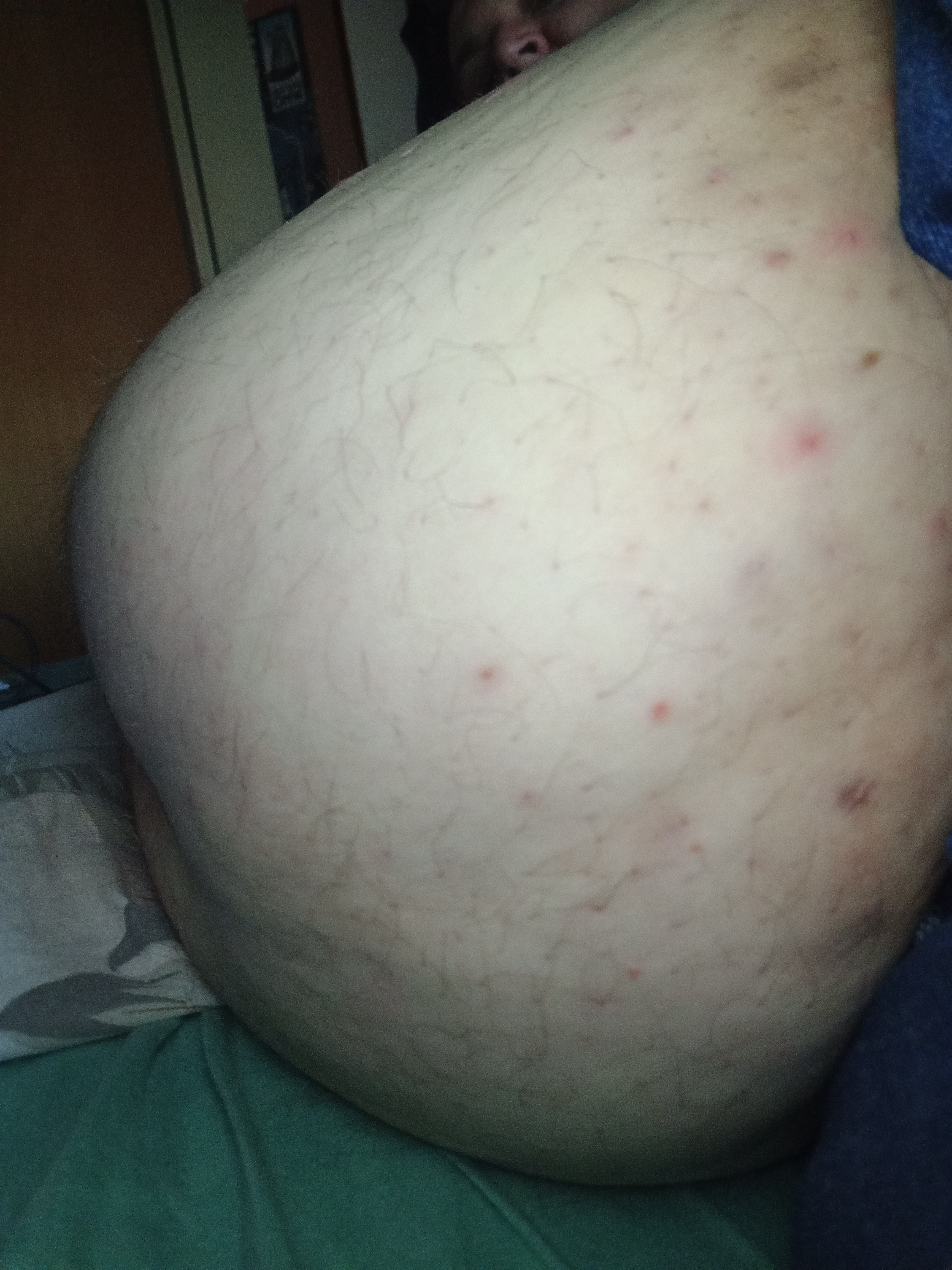 Bauch