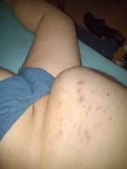 Unterbauch 2
